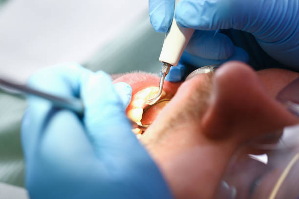 Best Emergency Denture Repair in Ashland, NJ